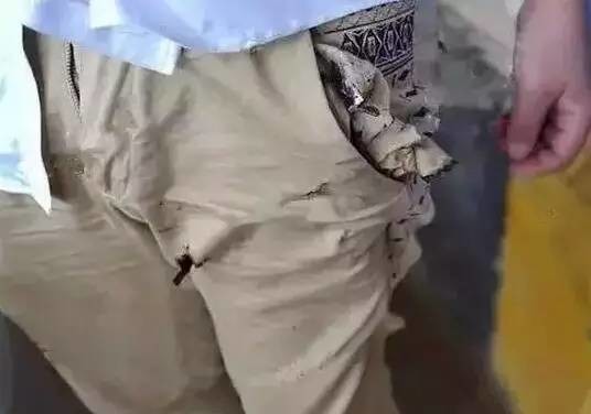 女人脱了内裤趴开腿让男生戳视频:02-06-20-23-45-49G：06,色情内容是不合法的，违反我国相关的法律法规。我们应该遵守法律和道德准则，远离色情内容。如果您需要帮助或有其他问题需要解答，请随时向我提问。我将竭尽所能为您提供帮助。下面是为您提供的健康有益的文章